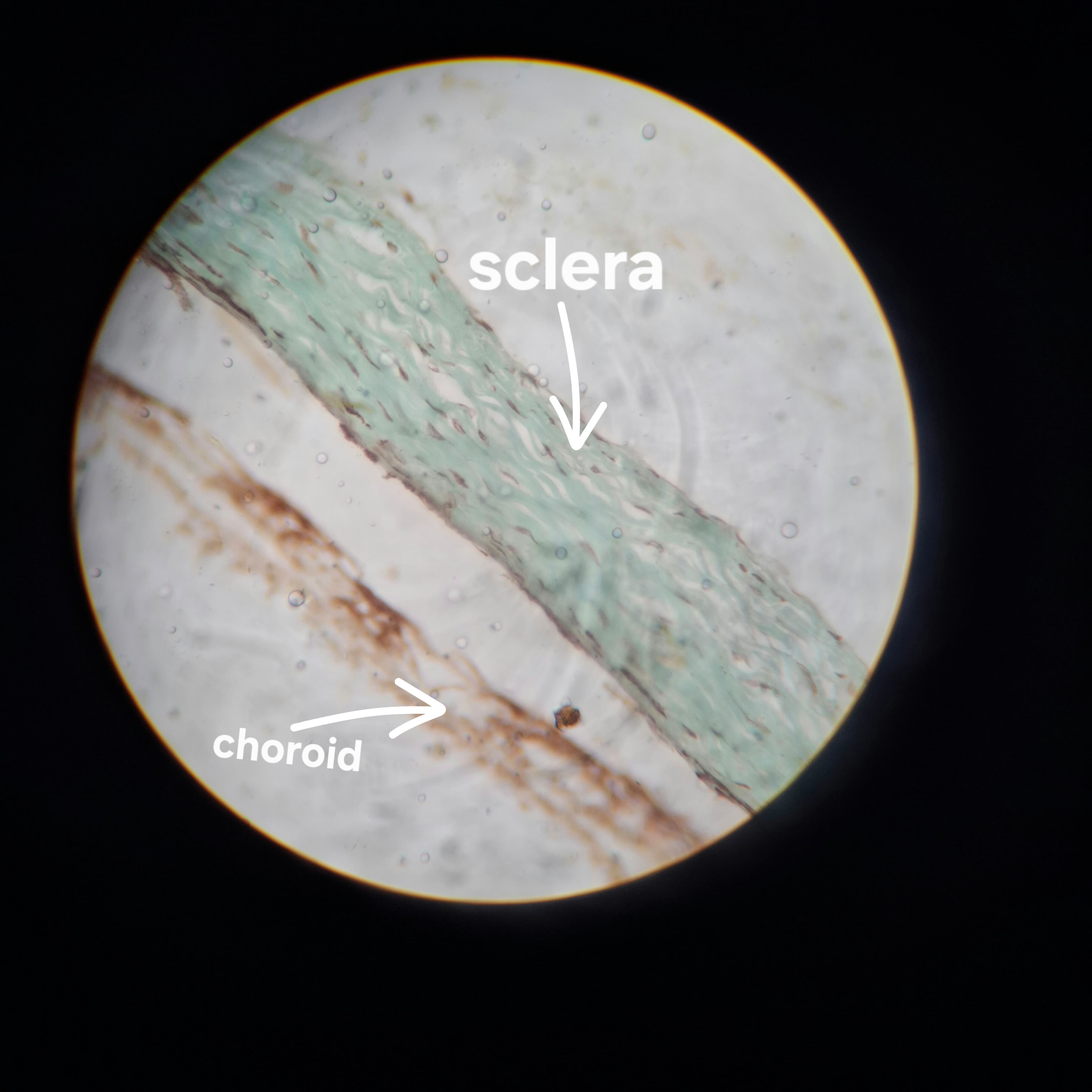 Sclera